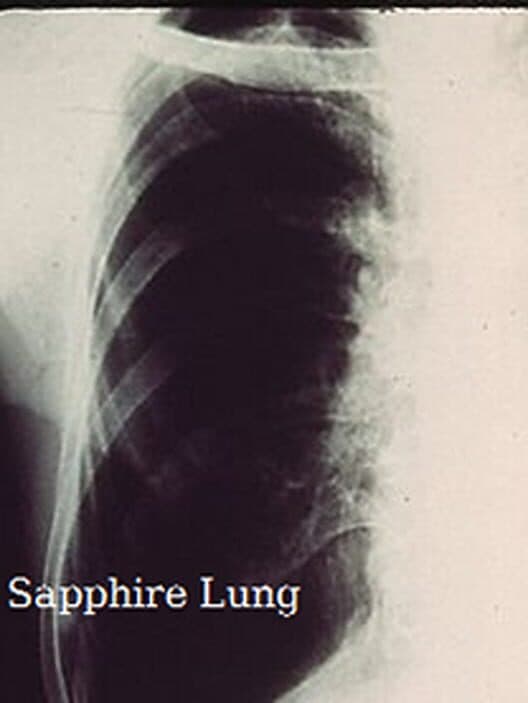 Обложка Sapphire Lung