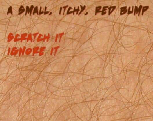 Обложка Itch