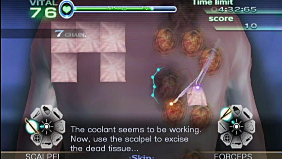 Скриншот 9 из Trauma Center: New Blood