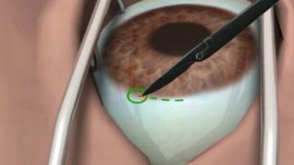 Скриншот 1 из Surgery Simulator