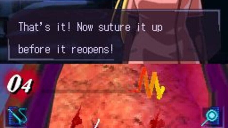Скриншот 2 из Trauma Center: Under the Knife