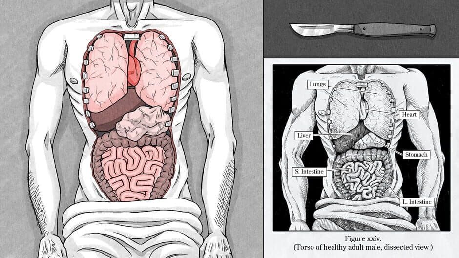 Скриншот 3 из Edwin Earstwhile: Medical Examiner